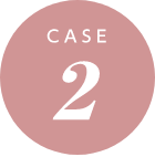 Case2